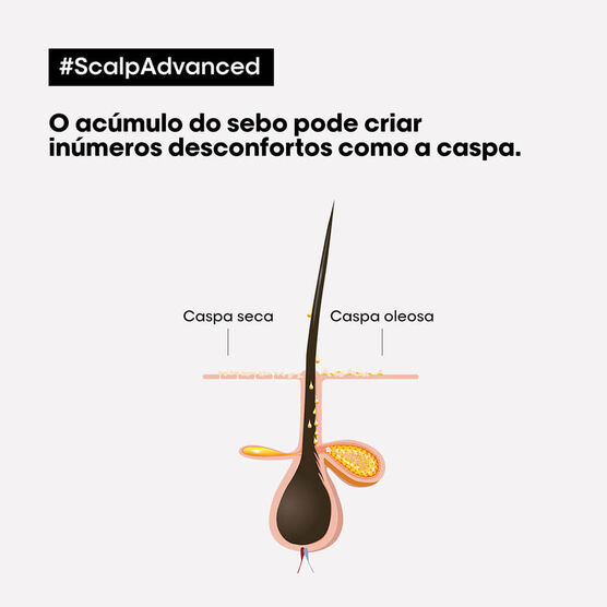 Serie Expert Scalp Shmp Antidandruff